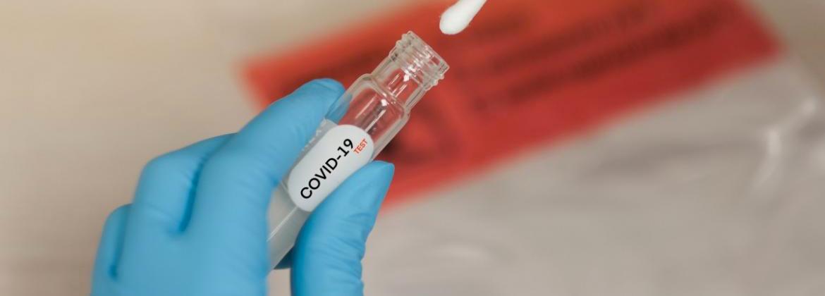 COVID-19 Testing: What you need to know